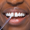 Kvinna med vita tänder och blekande glödstift från Diamond Smile på sin tand