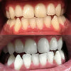 Experience Diamond Smile tandblekningsremsor med aktivt kol för hemblekning
