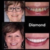 Whitening Munskölj iD+
