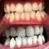 Tandblekning skum för vitare tänder