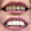 Whitening Munskölj iD+