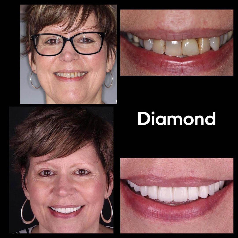 Whitening Munskölj iD+