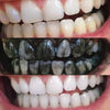 Tandblekning - vitare tänder med aktivt kol